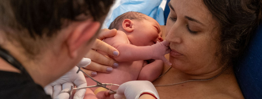 A mom with her newborn baby and her midwife is cutting the nuchal cord.